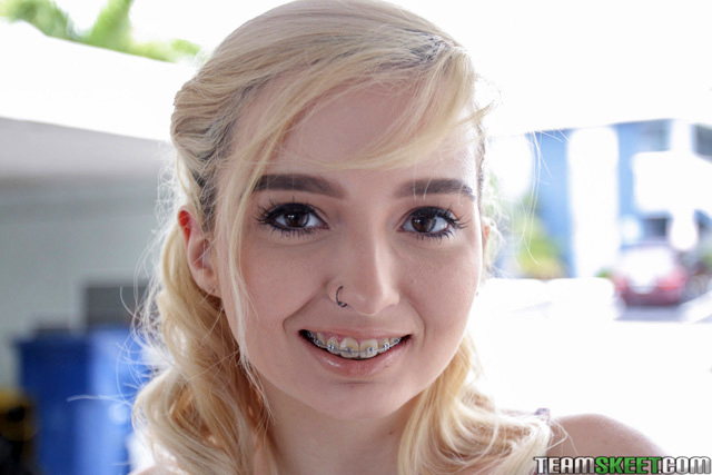 Porn With Braces